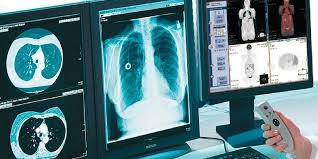 Avances Tecnológicos en un Centro Radiológico: Imágenes Detalladas para un Diagnóstico Preciso