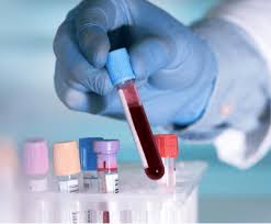 Importancia de la Clínica de Análisis de Sangre en el Cuidado de la Salud