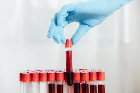 Importancia del Laboratorio de Análisis de Sangre en el Diagnóstico Médico